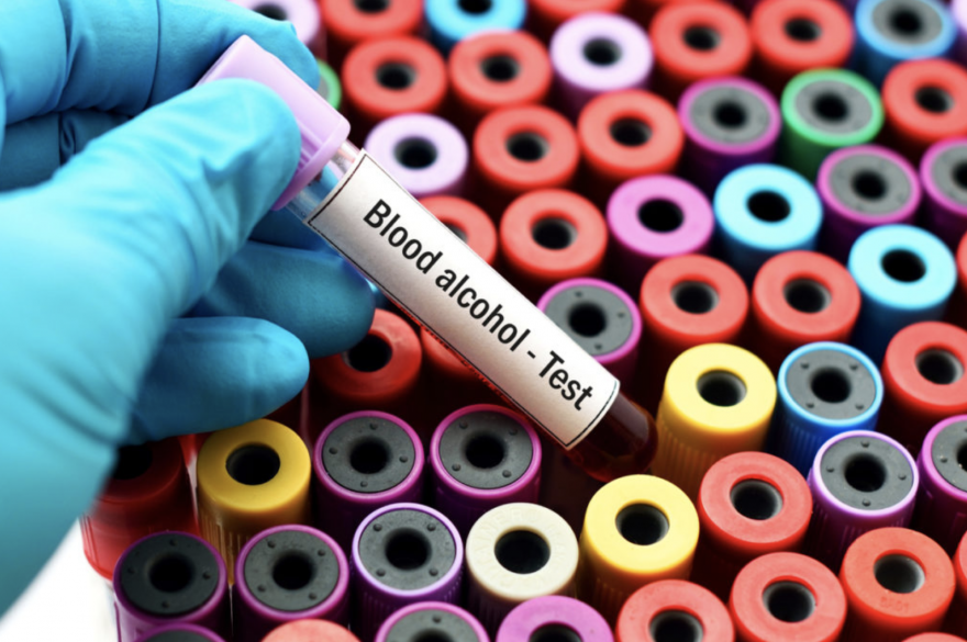 Alcohol Blood Testing: Traditional Vs PEth Testing