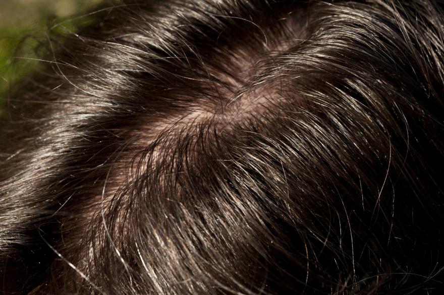 Alcohol Blood Testing: Hair strand testing combined with PEth