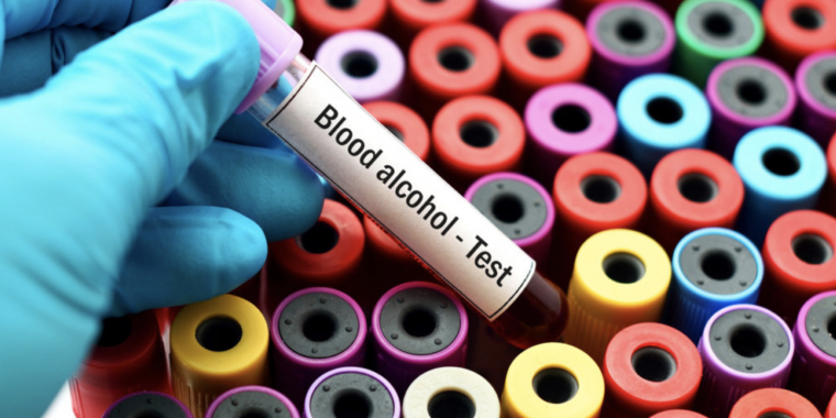 Alcohol Blood Testing: Traditional Vs PEth Testing