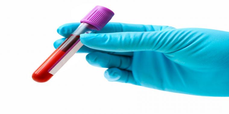 New Research into Hair and Blood Alcohol Testing