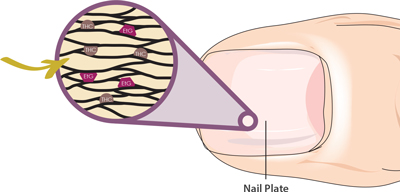 Fingernail Alcohol Abuse Test